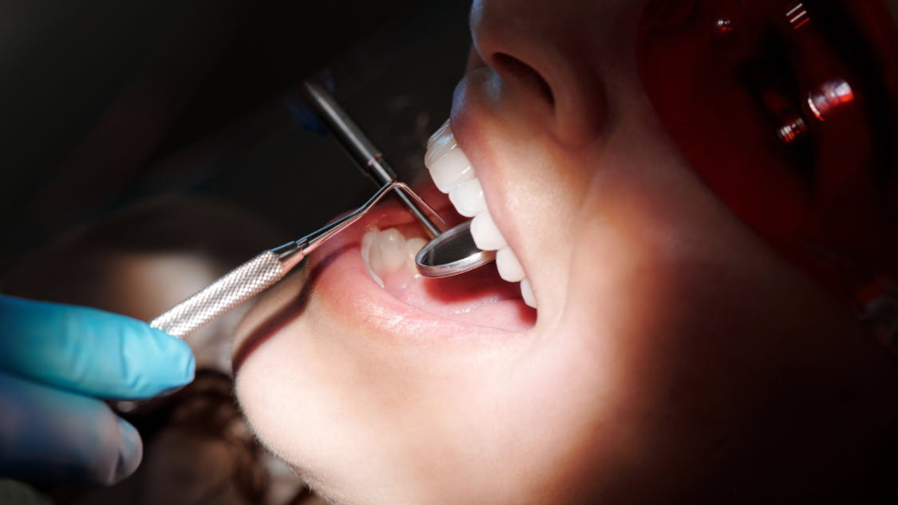 Professional Teeth Cleaning vs Home Cleaning What’s Better for Long Term Oral Health