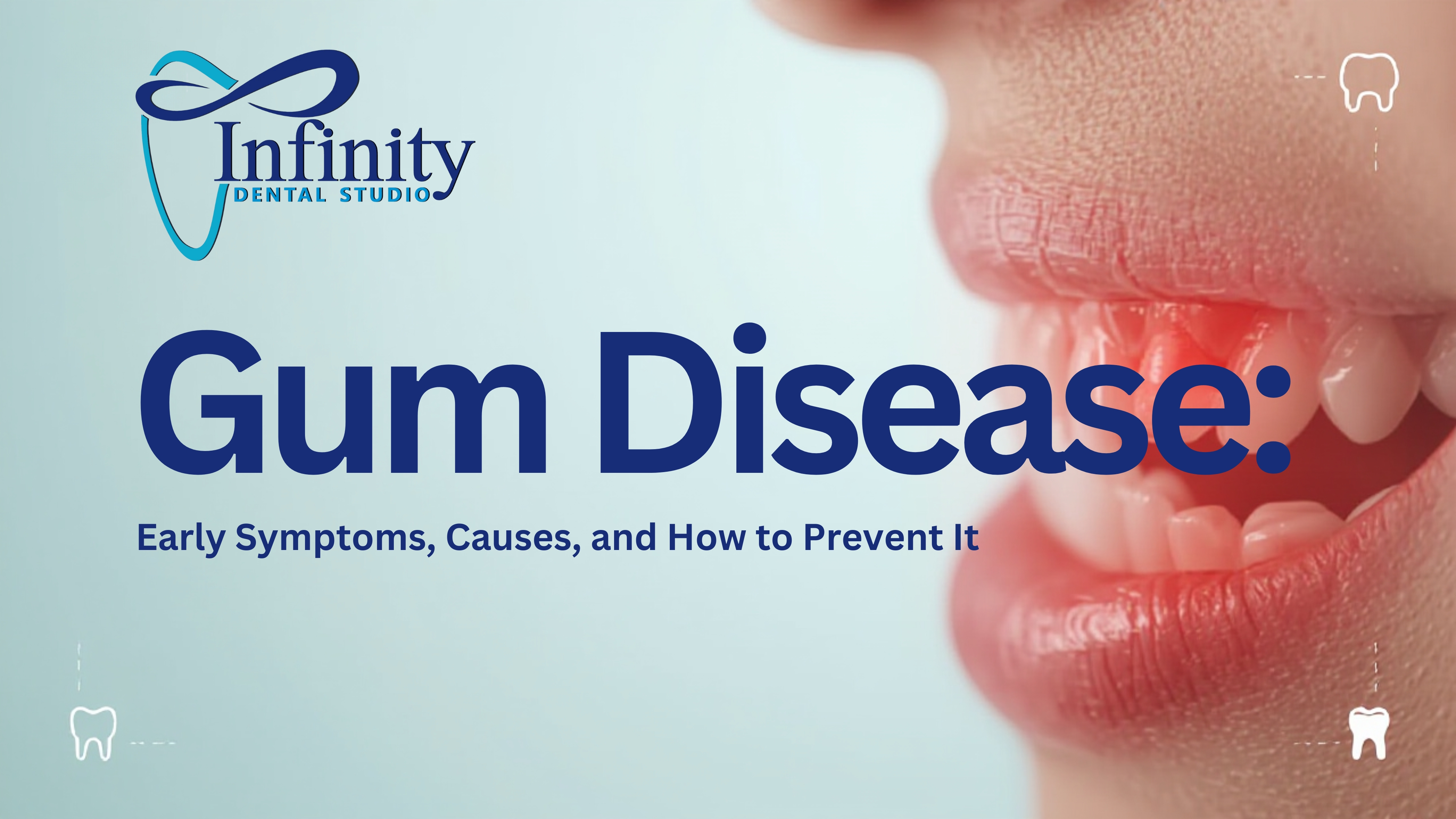 Gum Disease: Early Symptoms, Causes, and How to Prevent It